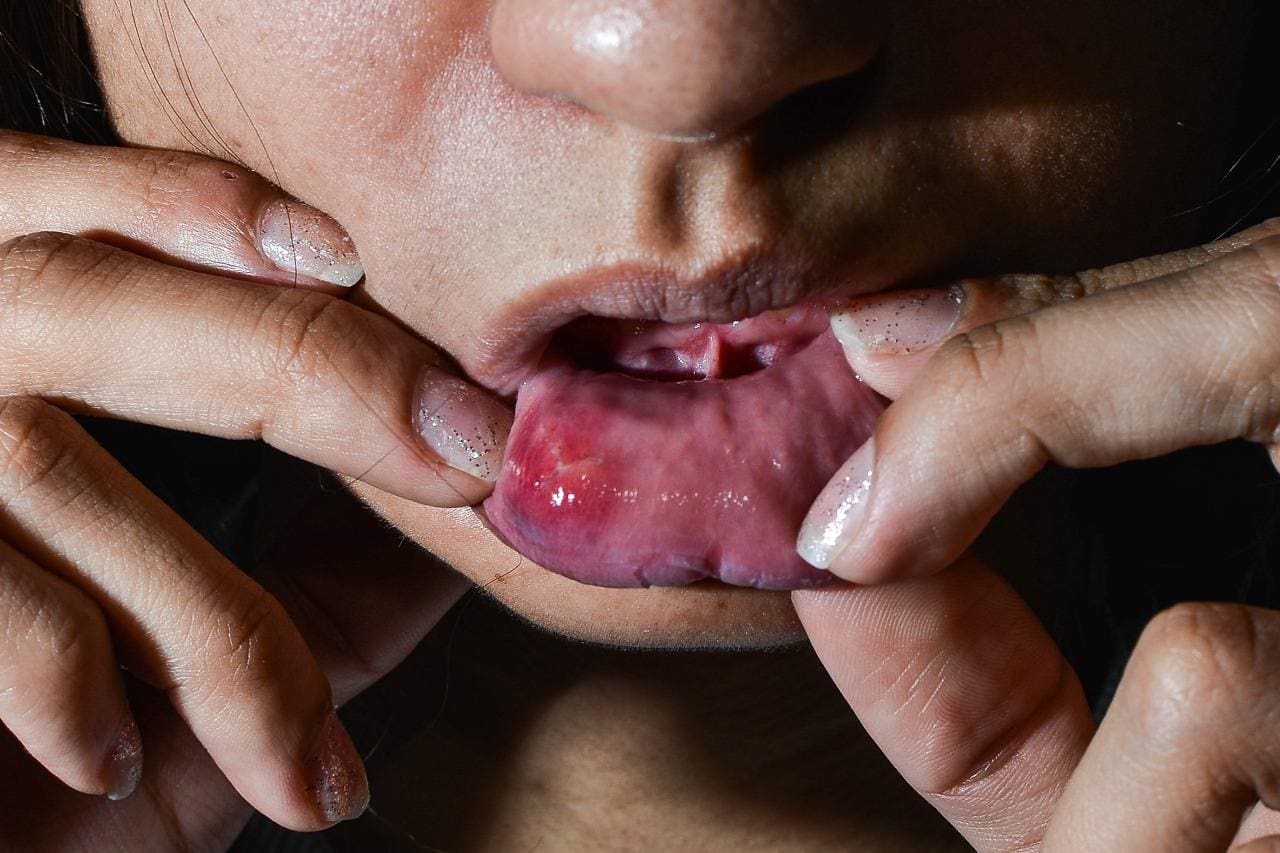Vítima disse que além da boca machucada, sente muitas dores pelo corpo