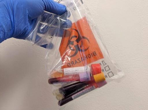 Esta imagem, cortesia de Diana Berrent, mostra frascos de sangue coletados no laboratório de patologia do Centro Médico Irving da Universidade de Columbia