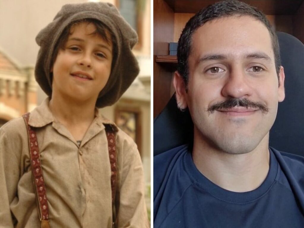 Antes e depois de David Lucas