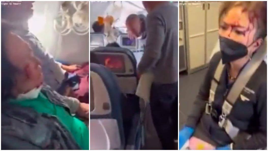 Turbulência em voo para o Havaí deixou 36 pessoas feridas