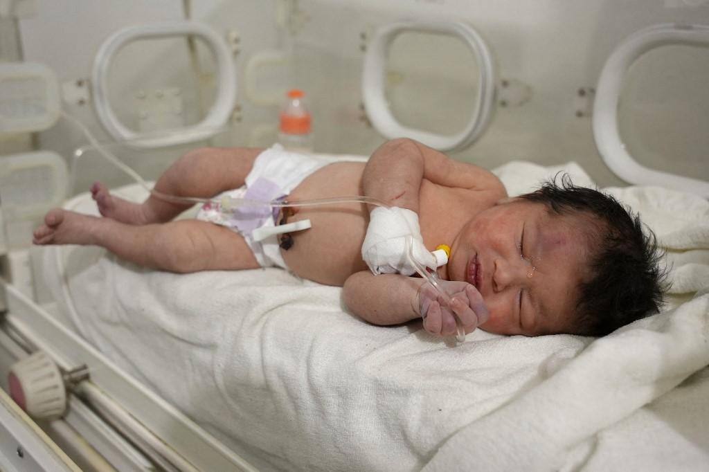 Bebê resgatada com cordão umbilical na síria