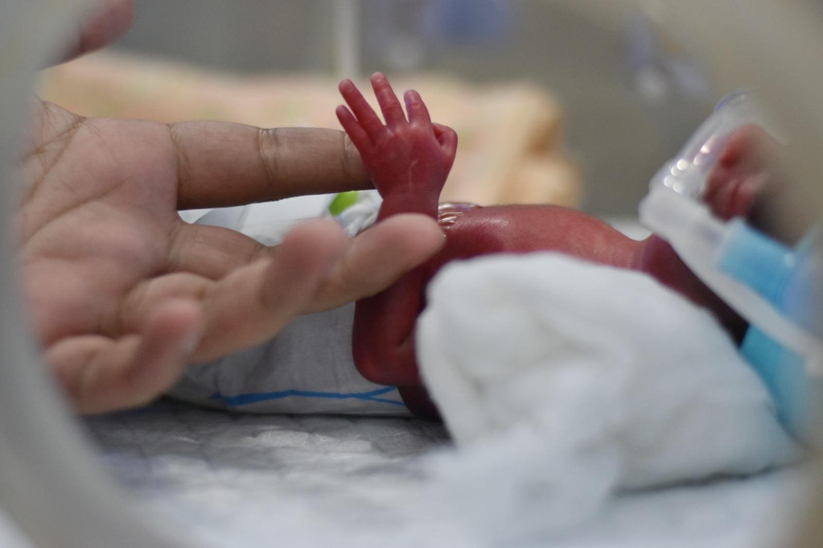Prematuridade no Brasil: um problema de saúde pública