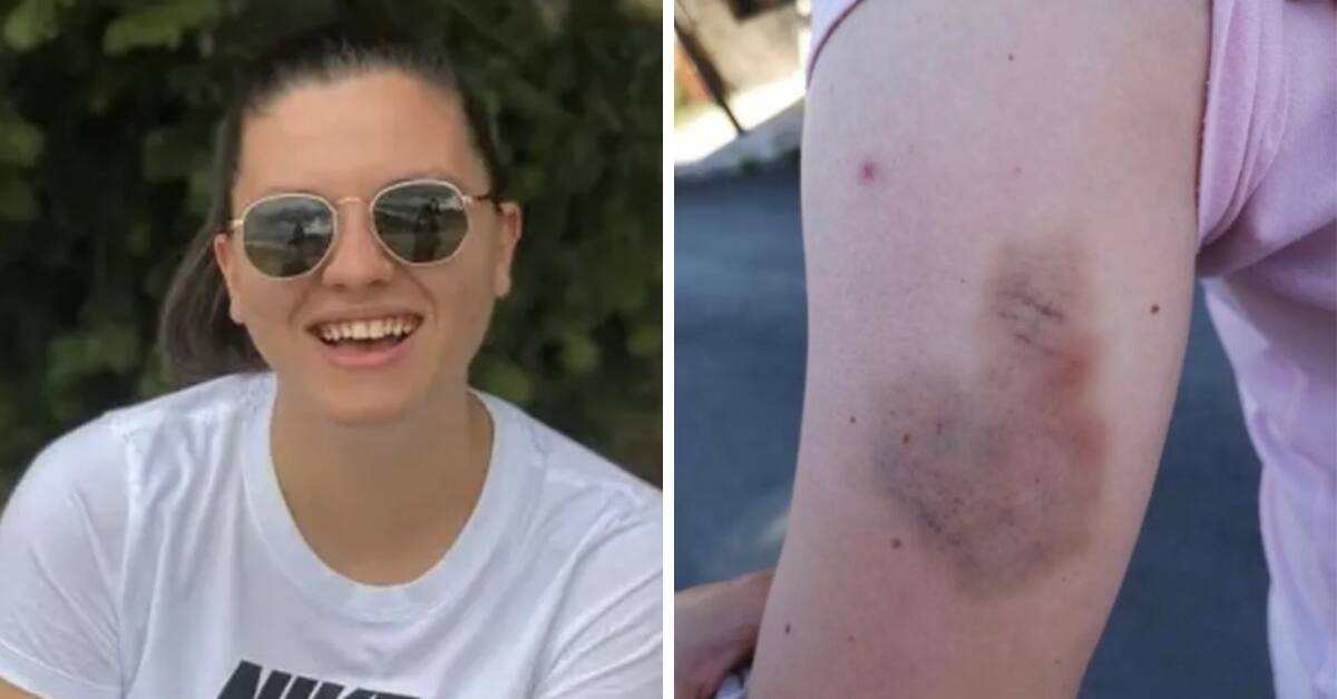Mulher agredida em Montenegrao age em legitima defesa e é multada mesmo assim