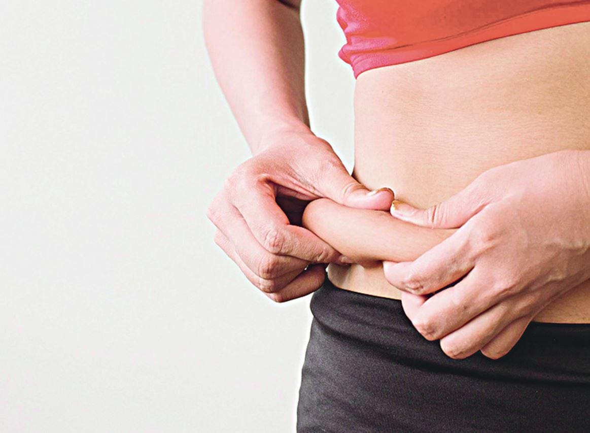 Distribuição Aquela ‘gordurinha’ pode estar armazenada em várias partes do corpo
