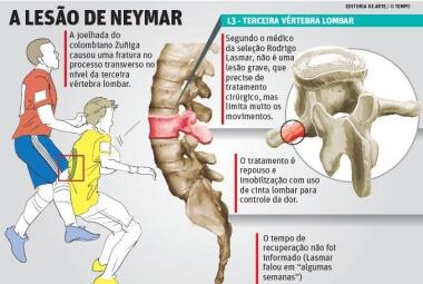 A lesão de Neymar