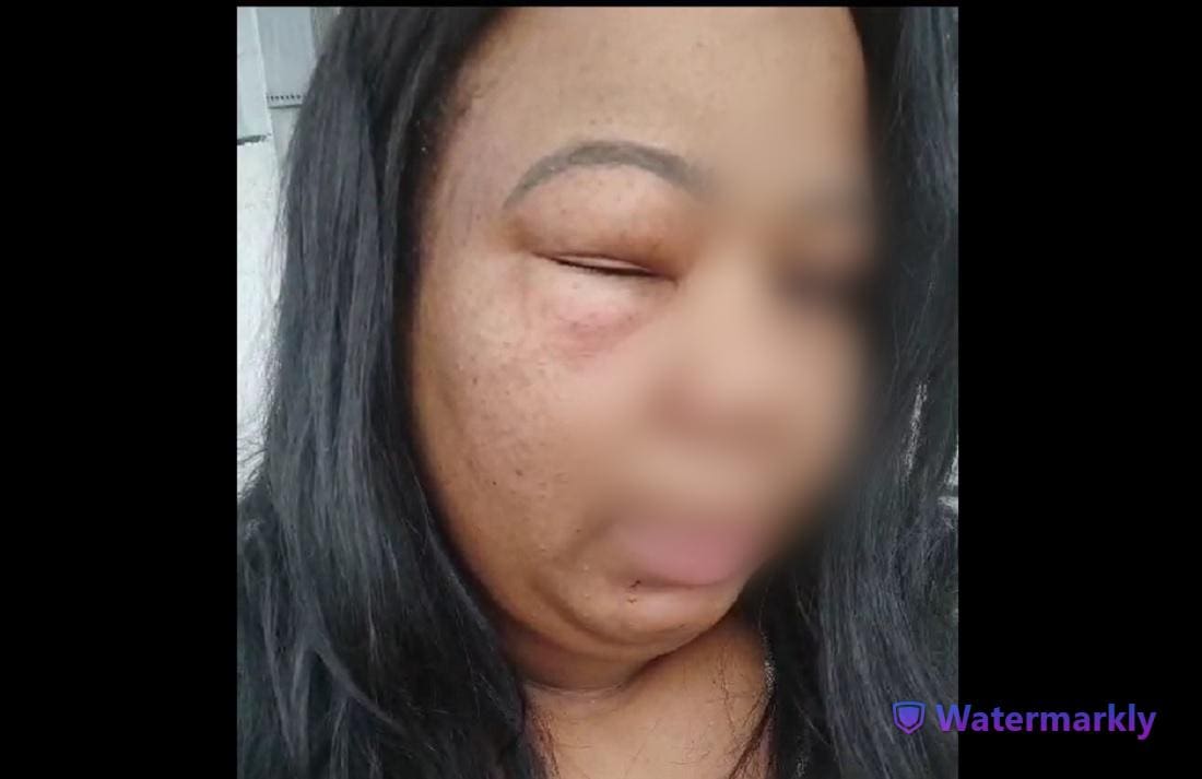 Vídeo que circula entre motoristas mostra a mulher com o rosto bastante machucado