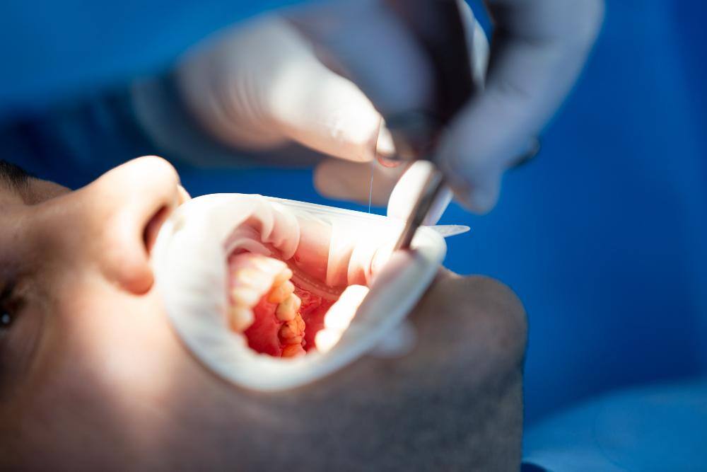 Extração de dente