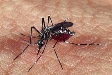 Zika