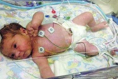Bebê nasce “morta”