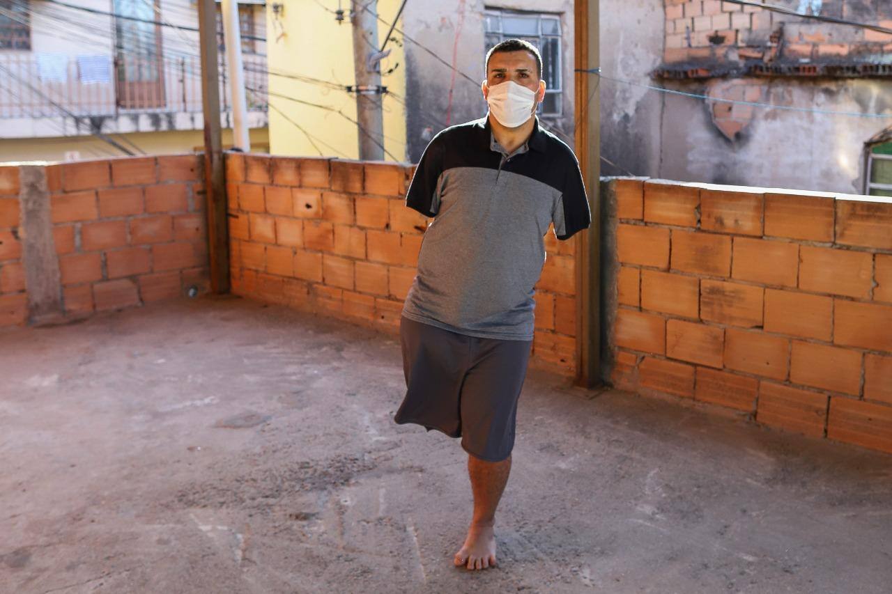 Técnico de futebol perdeu perna e braços aos 11 anos