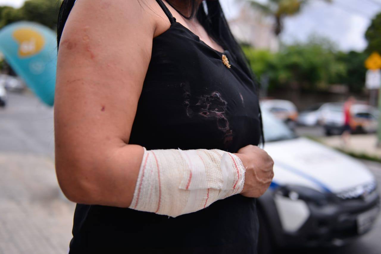 Uma das vítimas precisou levar 32 pontos no braço depois de ter sido atingida
