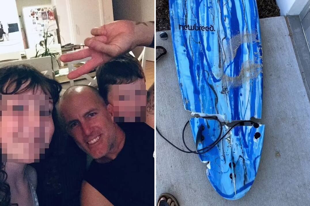 Toby Begg perdeu uma perna em um ataque de tubarão que também destruiu sua prancha
