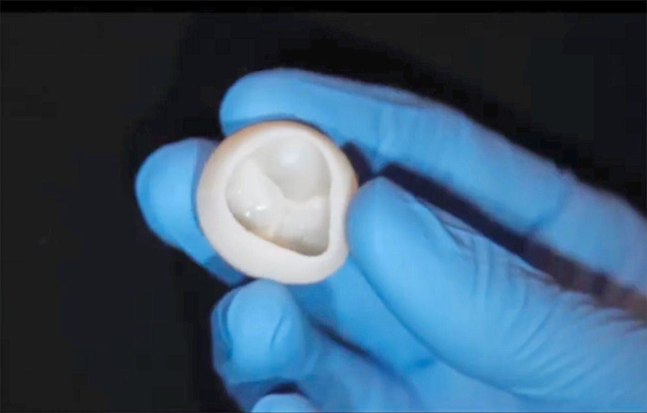 Em 3D: Válvula de coração que foi produzida a partir de colágeno funciona