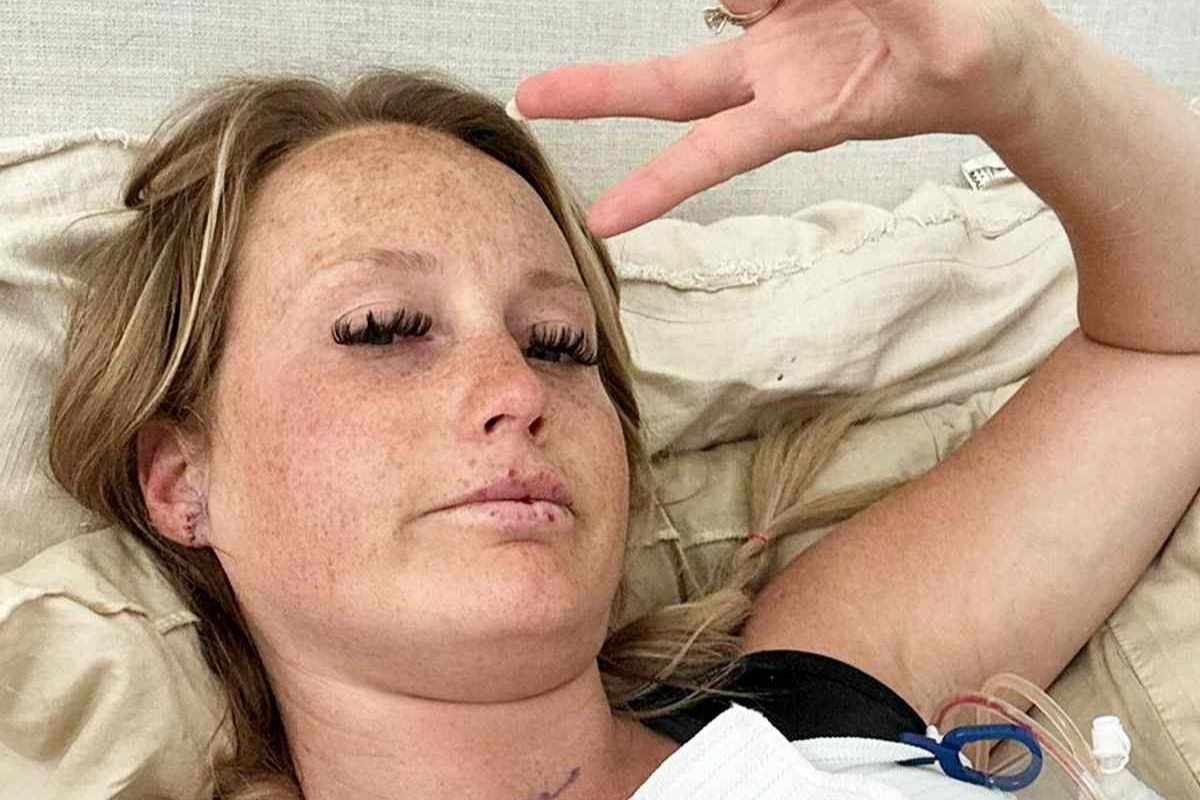 Amanda Wolaver, de 33 anos, sofreu graves sequelas após aplicação de botox