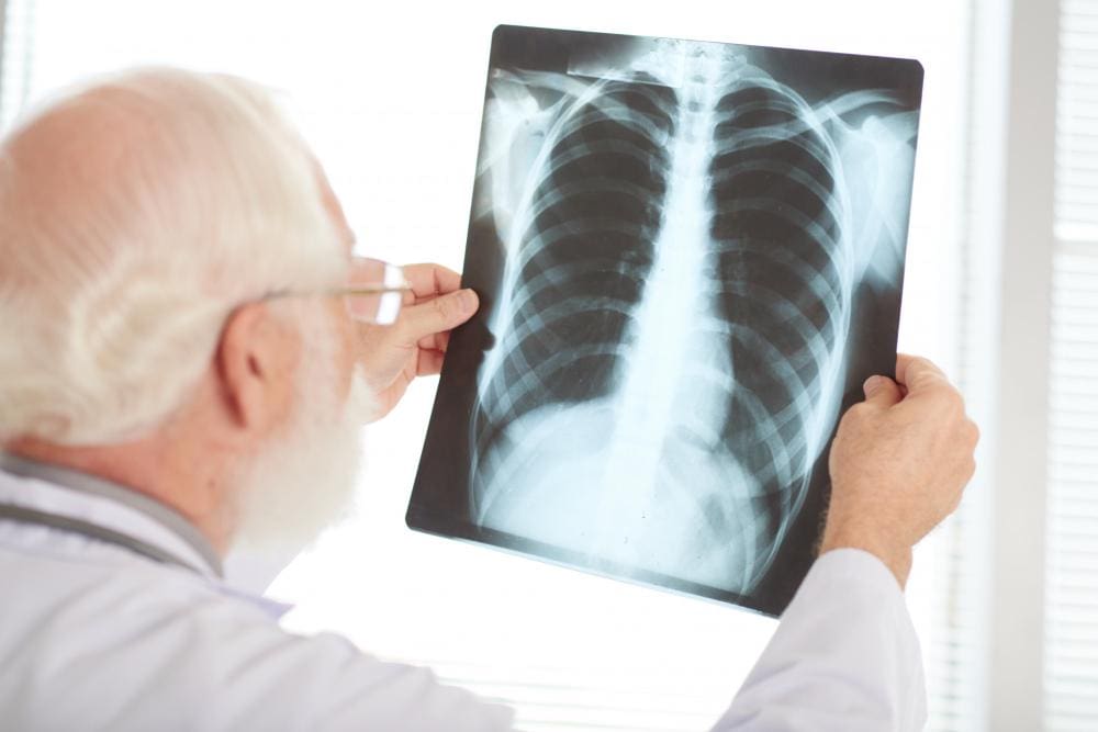Pneumonia