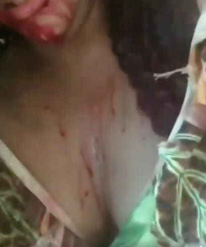 Blogueira aparece com o rosto sujo de sangue e as roupas rasgadas em um vídeo no Instagram