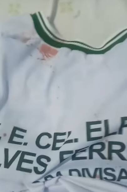 Aluno mostra uniforme com marca de sangue após ataque
