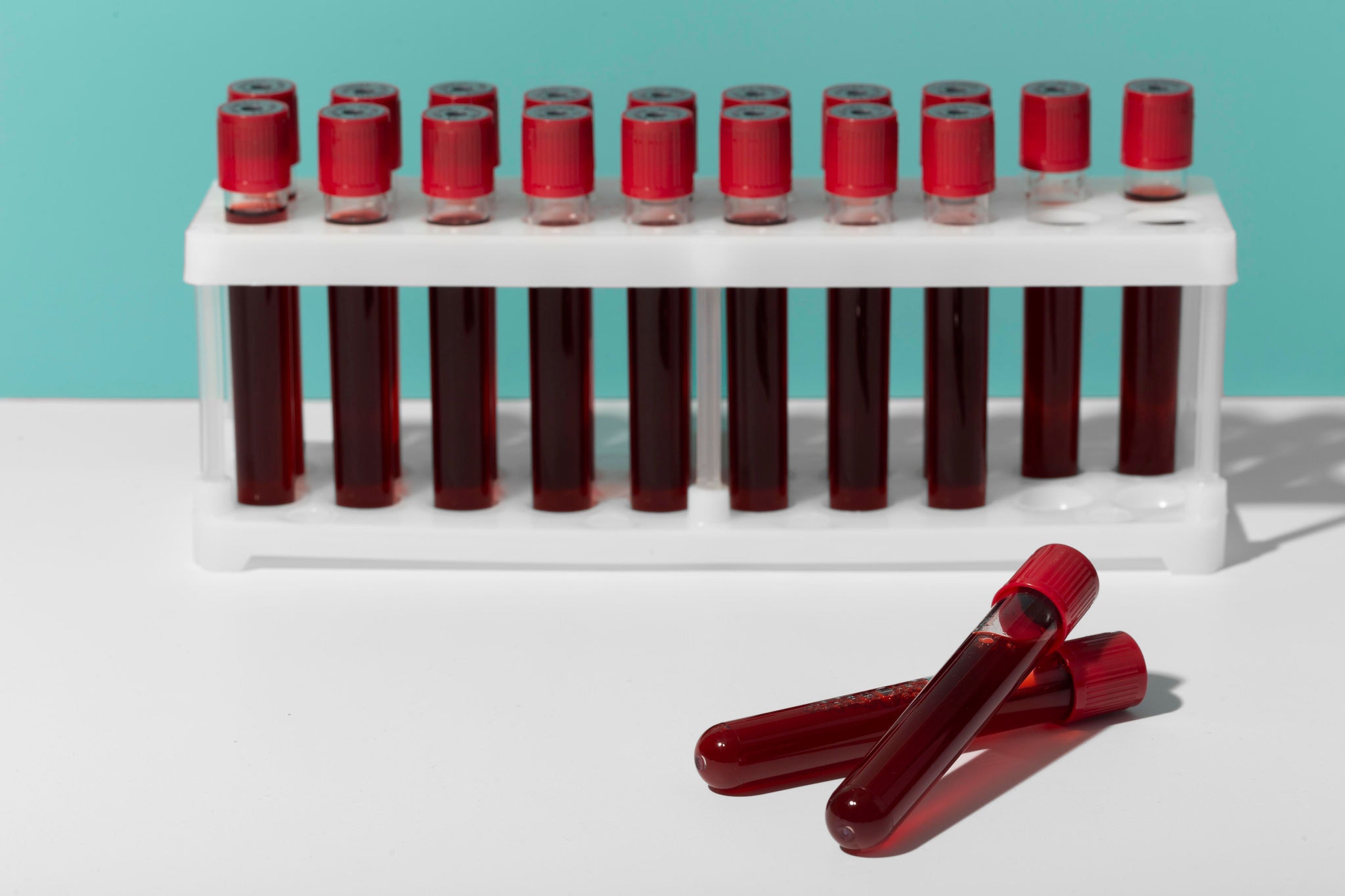 Durante seu período na universidade, Jian foi submetida a mais de 200 coletas de sangue realizadas por pessoas sem treinamento adequado (Imagem ilustrativa)