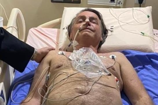 Bolsonaro foi intubado após ser internado por obstrução intestinal, diz jornal