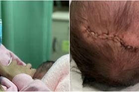 Polícia investiga traumatismo craniano sofrido por bebê em maternidade de BH