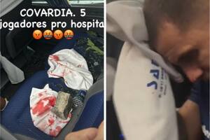 Ceará se solidariza com Fortaleza após ataque a ônibus; jogadores estão feridos